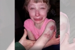 lilly special needs child, school bus, 10 year old special needs child brutally bitten on arm while returning home in school bus, Special needs child