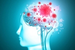 headache, virus, coronavirus is capable of affecting the brain study, Brains