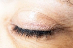 Eyelash Dandruff breaking, Eyelash Dandruff latest, all about eyelash dandruff, Dandruff