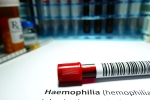 Hemophilia doctors, Hemophilia, why are men likely to develop hemophilia, Brain hemorrhage