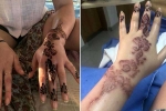 how long does black henna reaction last, side effects of henna tattoo, henna tattoo cause aussie woman to almost lose her hand, Tattoos