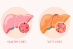 Grade 2 Fatty Liver medication, Grade 2 Fatty Liver news, how to reverse grade 2 fatty liver, Diabetes