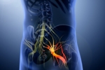 Sciatica nerve disorder, Sciatica nerve disorder, help yourself on sciatica, Pinched nerve