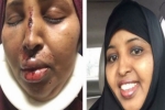 White Supremacist, White Supremacist Attacked Somali Woman, somali woman attacked by white supremacist, Medical costs White Supremacist, White Supremacist Attacked Somali Woman, somali woman attacked by white supremacist, Medical costs