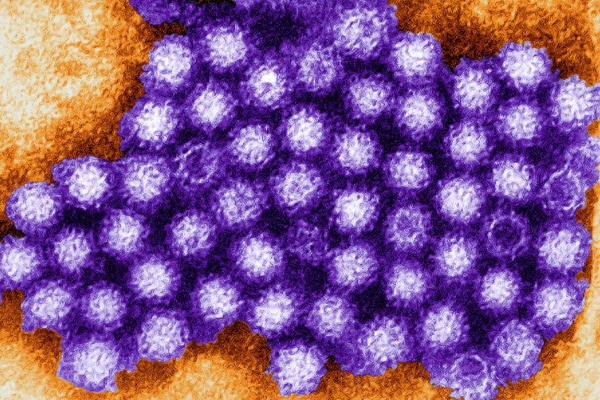 200 Ohio university students sick by norovirus},{200 Ohio university students sick by norovirus
